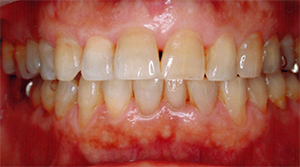 山口県知事賞受賞者85歳男性