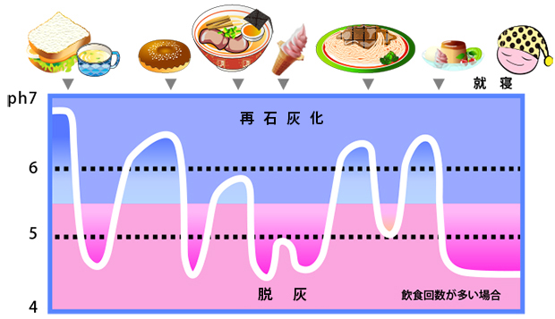 ステファンカーブ